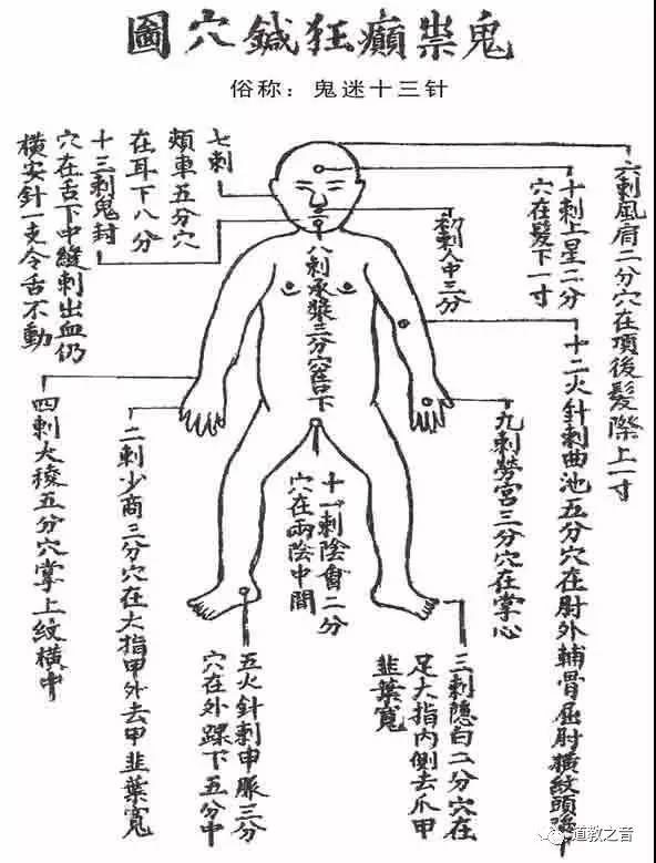 《古董局中局》中的鬼门十三针真的存在吗？